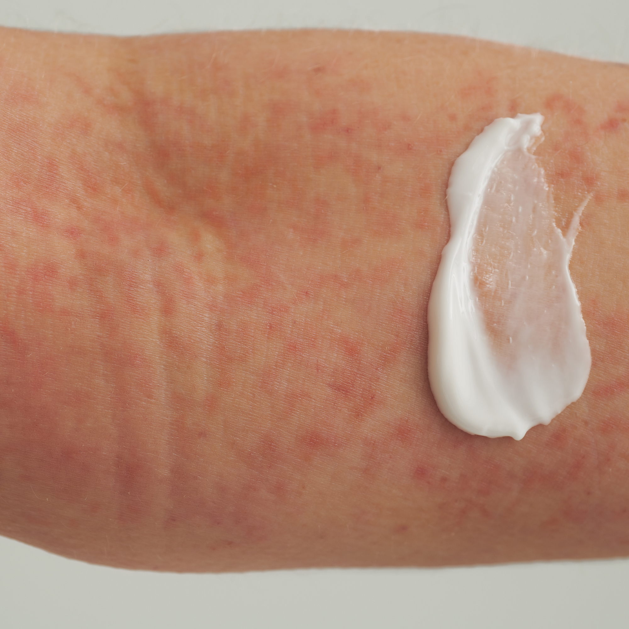 EXTRODERM HAUTBALSAM Kennenlerngröße