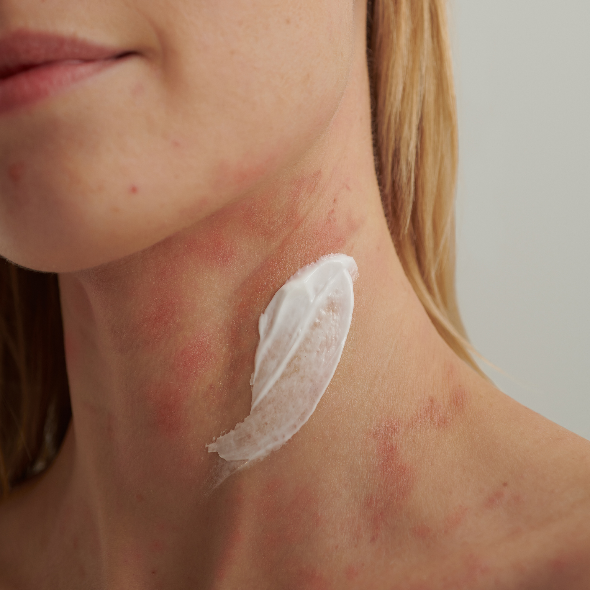 EXTRODERM INTENSIVCREME Kennenlerngröße