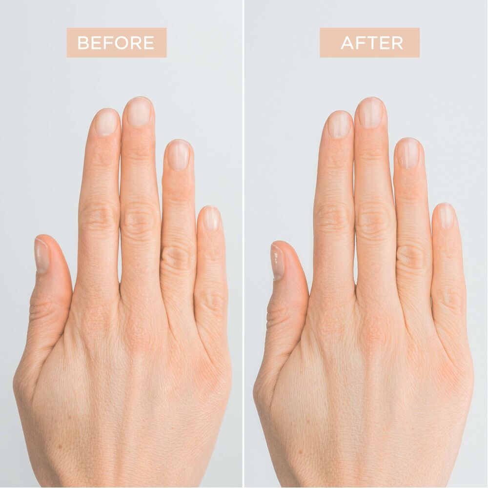 Natural Nail Treatment
