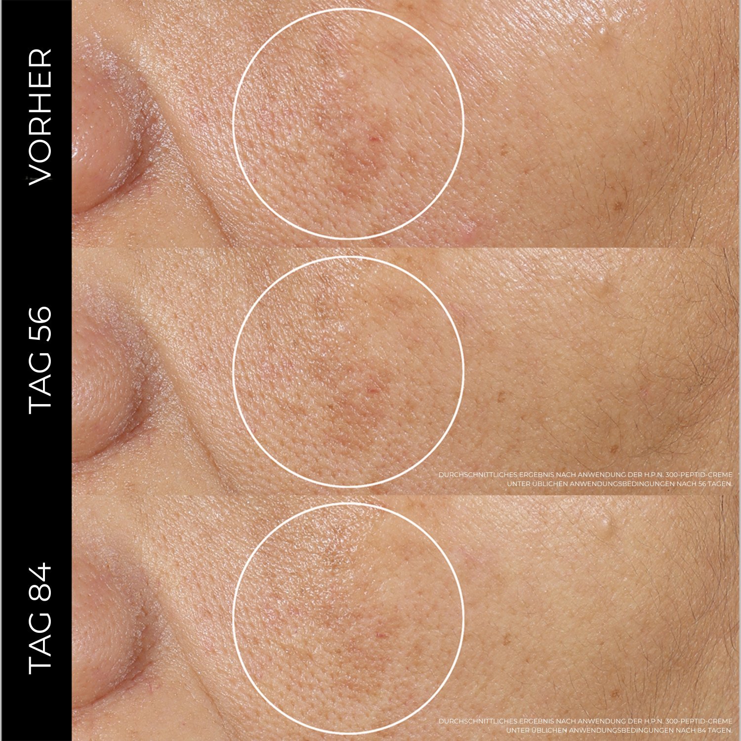 Rénergie H.P.N. 300-Peptide Cream