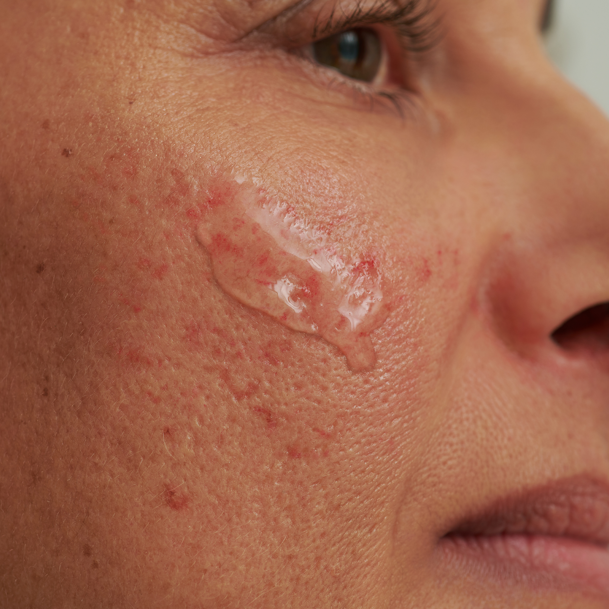 SENSACEA INTENSIVSERUM Kennenlerngröße